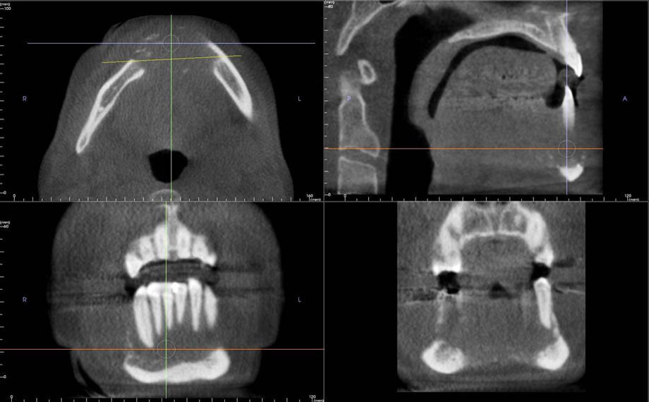 Dental Radiology Diagnostics